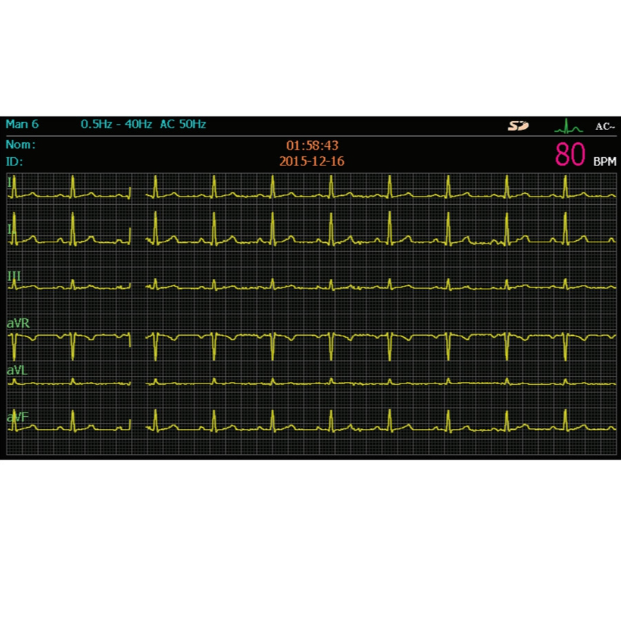 Electrocardiographe Spengler Cardiomate 6