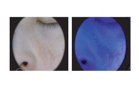 Lampe diagnostique pour dermatologie lumière LED et UV variable